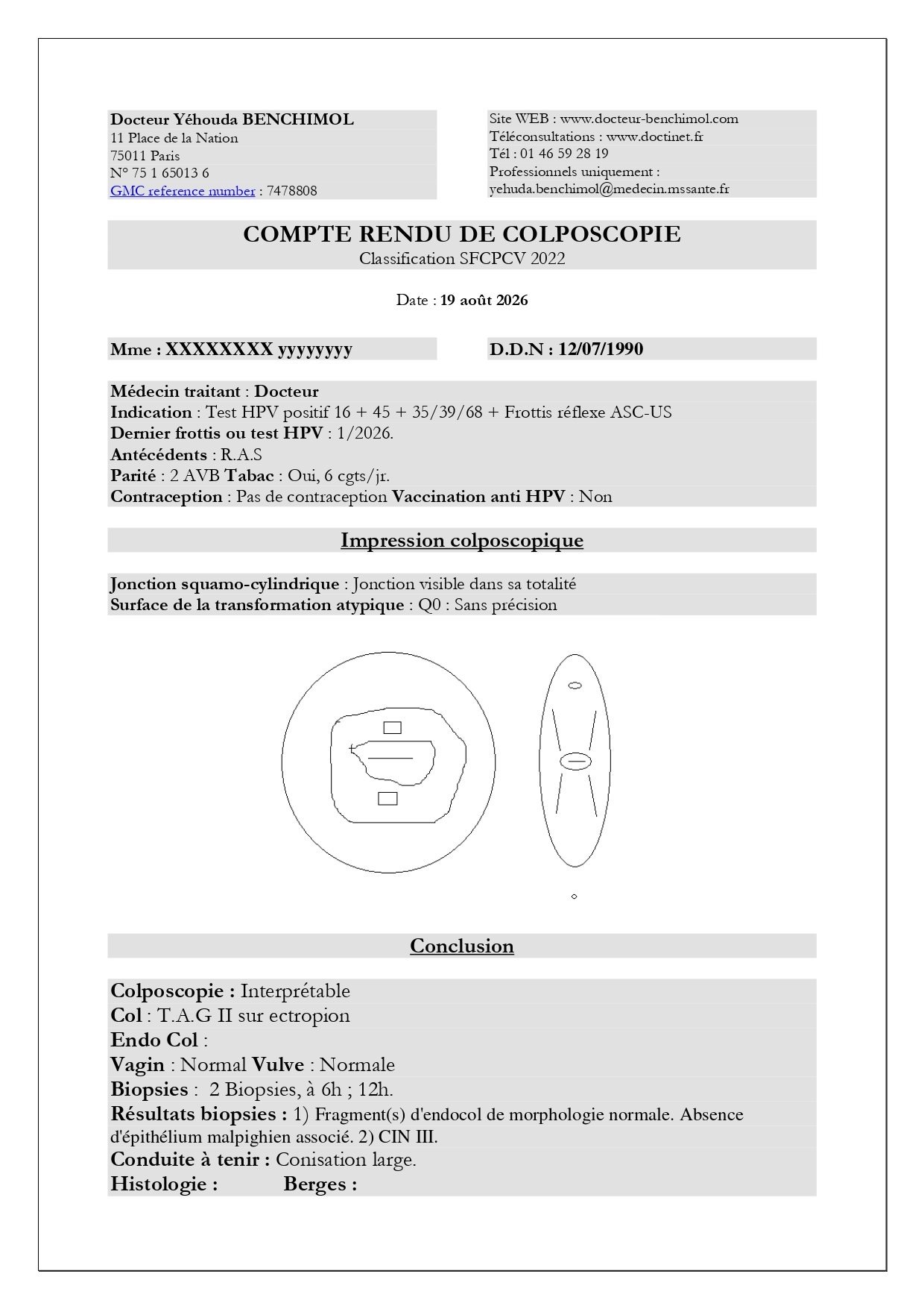 Compte rendu de colposcopie Compte rendu de colposcopie