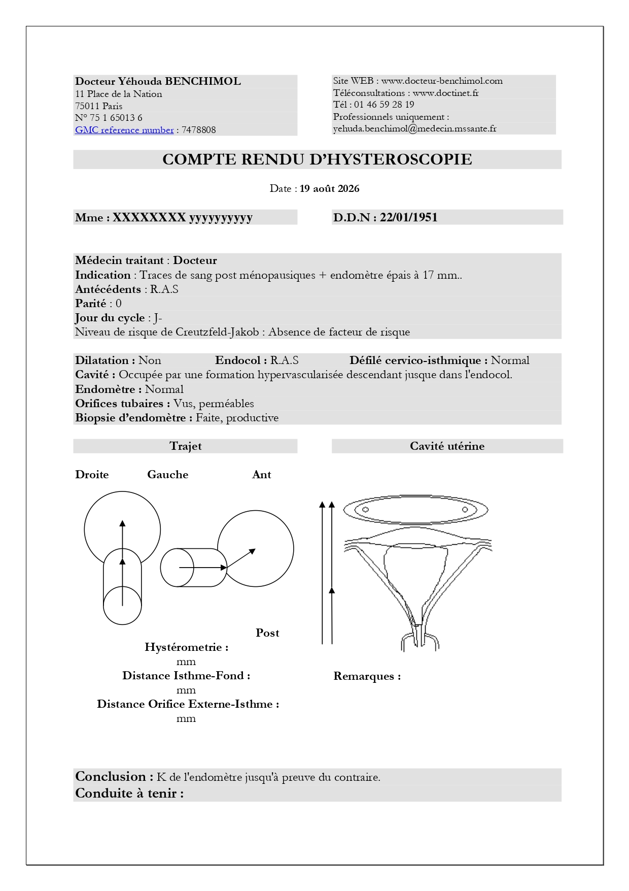 Compte rendu d'hystéroscopie